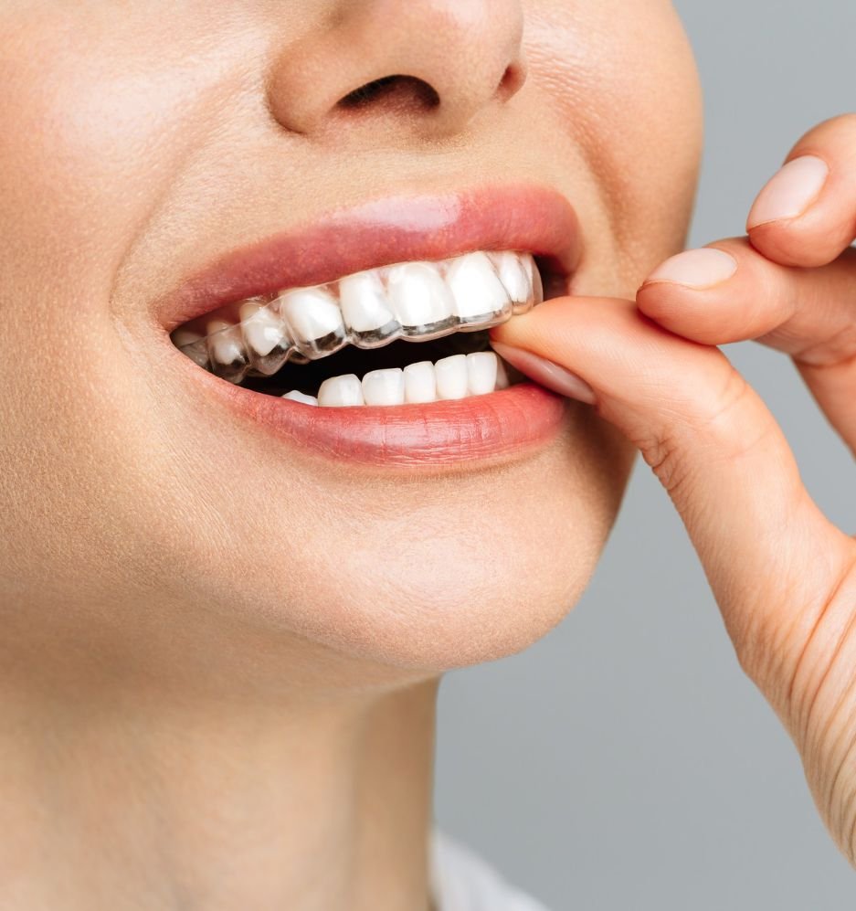 Protocolo de Carga Imediata